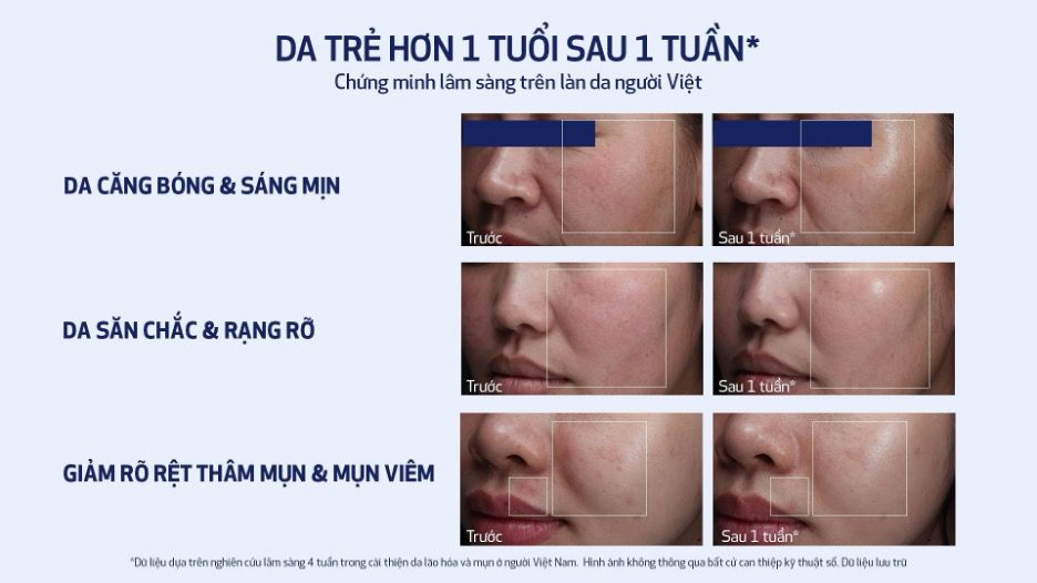Obagi ch&iacute;nh thức ra mắt serum trẻ h&oacute;a da cấp độ tế b&agrave;o NU-GEN&trade; tại Việt Nam