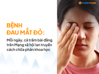 YouNet Media: Thống kê thảo luận về bệnh đau mắt đỏ – Mỗi ngày, cả trăm bài đăng lan truyền cách chữa phản khoa học